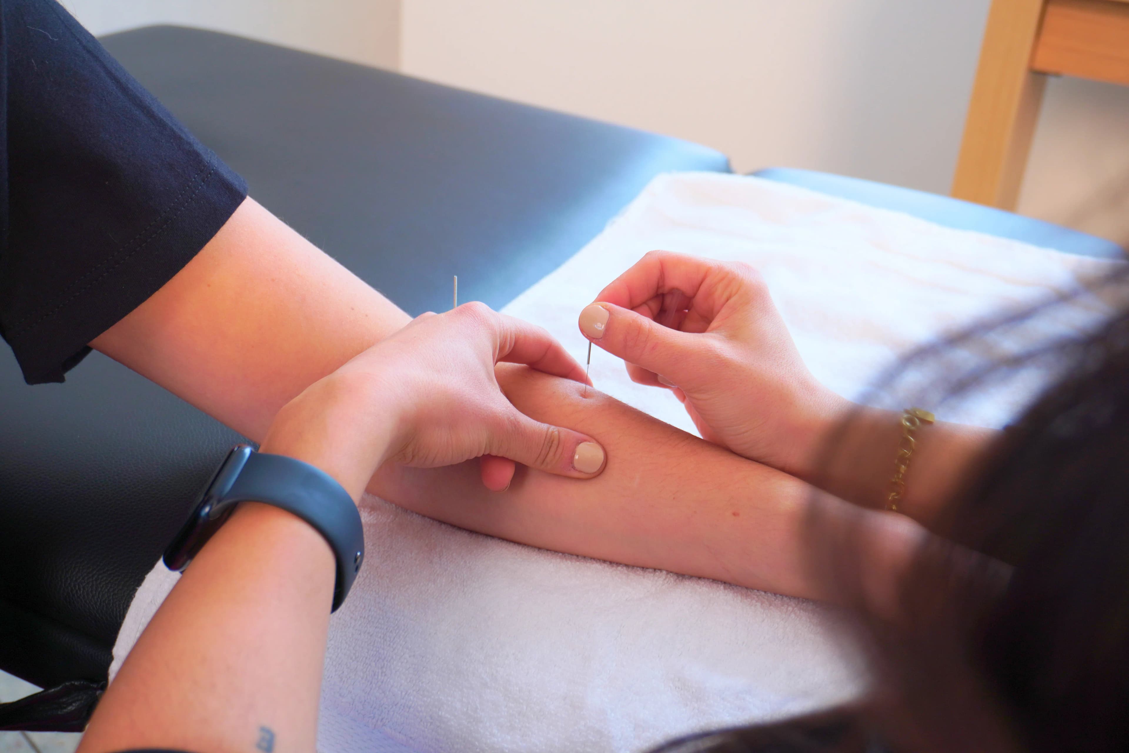 Acupuncture needles applied to patient's hand and wrist